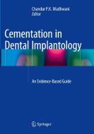 Cementation In Dental Implantology edito da Springer-verlag Berlin And Heidelberg Gmbh & Co. Kg