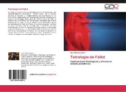 Tetralogía de Fallot di Alvin Mena Cantero edito da EAE