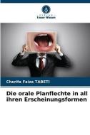 Die orale Planflechte in all ihren Erscheinungsformen di Cherifa Faiza Tabeti edito da Verlag Unser Wissen