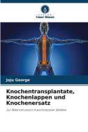 Knochentransplantate, Knochenlappen und Knochenersatz di Joju George edito da Verlag Unser Wissen