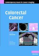 Colorectal Cancer di Gina Brown edito da Cambridge University Press