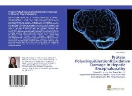 Protein Polyubiquitination&Oxidative Damage in Hepatic Encephalopathy di Jasmin Klose edito da Südwestdeutscher Verlag für Hochschulschriften AG  Co. KG