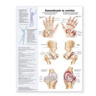 Understanding Arthritis Spanish edito da Lippincott Williams And Wilkins