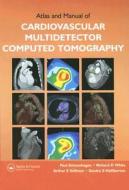 Atlas and Manual of Cardiovascular Multidetector Computed Tomography [With CDROM] di Paul Schoenhagen, Richard D. White edito da Taylor & Francis Group