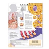 High Cholesterol Anatomical Chart In Spanish (colesterol Alto) di Anatomical Chart Company edito da Lippincott Williams And Wilkins