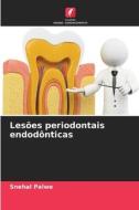 Lesões periodontais endodônticas di Snehal Palwe edito da Edições Nosso Conhecimento