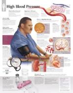 High Blood Pressure Laminated Poster di Scientific Publishing edito da Scientific Publishing Limited