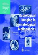Radiological Imaging in Hematological Malignancies edito da Springer Berlin Heidelberg