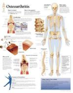 Osteoarthritis Laminated Poster di Scientific Publishing edito da Scientific Publishing Limited