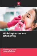 Mini-implantes em ortodontia di Ambika Jayaram, Sunil Muddiah edito da Edições Nosso Conhecimento