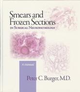 Smears and Frozen Sections in Surgical Neuropathology: A Manual di Peter Burger edito da UNIV OF AKRON PR