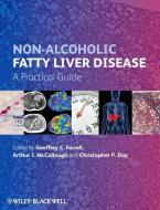 Non-Alcoholic Fatty Liver Disease di Geoffrey C. Farrell edito da Wiley-Blackwell