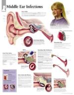 Middle Ear Infections Paper Poster di Scientific Publishing edito da Scientific Publishing Limited