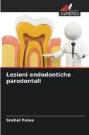 Lesioni endodontiche parodontali di Snehal Palwe edito da Edizioni Sapienza