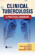 Clinical Tuberculosis di Peter Davies, Peter Barnes, Stephen Gordon edito da Taylor & Francis Ltd