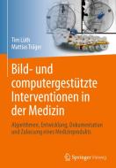 Bild- und computergestützte Interventionen in der Medizin di Tim Christian Lüth, Mattias Felix Träger edito da Springer-Verlag GmbH