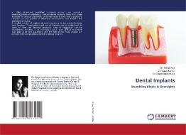 Dental Implants di Dr Geeta Arya, Dr Varun Kumar, Dr Shambhavi Shukla edito da Lap Lambert Academic Publishing
