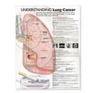 Understanding Lung Cancer Anatomical Chart edito da Lippincott Williams And Wilkins