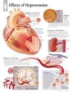 Effects Of Hypertension Paper Poster di Scientific Publishing edito da Scientific Publishing Limited