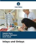 Inlays und Onlays di Sakshi Gera, Pardeep Mahajan, Amit Sood edito da Verlag Unser Wissen