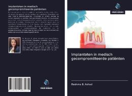 Implantaten in medisch gecompromitteerde patiënten di Reshma B. Avhad edito da Uitgeverij Onze Kennis