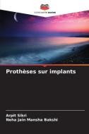 Prothèses sur implants di Arpit Sikri, Neha Jain Mansha Bakshi edito da Editions Notre Savoir