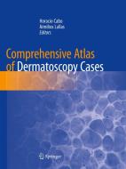 Comprehensive Atlas Of Dermatoscopy Cases edito da Springer Nature Switzerland Ag