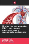 Fibrina rica em plaquetas (PRF): Um raio de esperança para a regeneração periodontal di Pranav S. Patil, Bushra K. Quazi, Prasad V. Dhadse edito da Edições Nosso Conhecimento