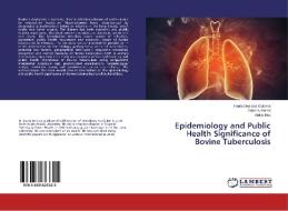Epidemiology and Public Health Significance of Bovine Tuberculosis di Fanta Desissa Gutema, Gobena Ameni, Akililu Biru edito da LAP Lambert Academic Publishing
