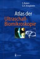 Atlas Der Ultraschall-Biomikroskopie di Sigrid Roters, G]nter K. Krieglstein, Gunter K. Krieglstein edito da Springer