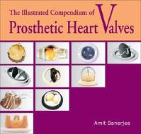 The Illustrated Compendium Of Prosthetic Heart Valves di Amit Banerjee edito da Academic Foundation