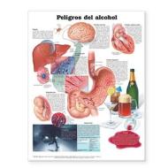 Dangers Of Alcohol Anatomical Chart In Spanish (peligros Del Alcohol) edito da Lippincott Williams And Wilkins