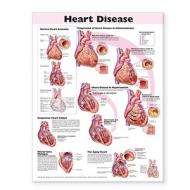 Heart Disease Anatomical Chart di Anatomical Chart Company edito da Lippincott Williams And Wilkins