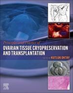 Ovarian Freezing and Transplantation edito da ELSEVIER