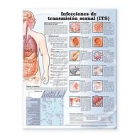 Sexually Transmitted Infections Anatomical Chart In Spanish (infecciones De Transmision Sexual) edito da Lippincott Williams And Wilkins