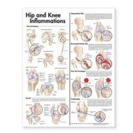 Hip And Knee Inflammations Anatomical Chart edito da Lippincott Williams And Wilkins