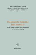 Die Künstliche Zahnreihe beim Zahnlosen di Spreng edito da Birkhäuser Basel