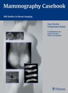 Mammography Casebook di Uwe Fischer edito da Thieme Publishing Group