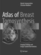 Atlas Of Breast Tomosynthesis di Martin Sonnenschein, Christian Waldherr edito da Springer International Publishing Ag