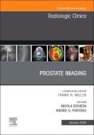 Prostate Imaging, an Issue of Radiologic Clinics of North America: Volume 62-1 edito da ELSEVIER