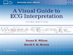 A Visual Guide To ECG Interpretation di Wilcox & Brown edito da Wolters Kluwer Health