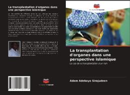 La Transplantation D'organes Dans Une Perspective Islamique di Sirajudeen Adam Adebayo Sirajudeen edito da KS OmniScriptum Publishing