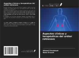 Aspectos clínicos y terapéuticos del uréter retrocavo di Ahmed Chaabouni, Wafa Elleuch edito da Ediciones Nuestro Conocimiento