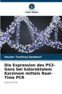 Die Expression des P53-Gens bei kolorektalem Karzinom mittels Real-Time PCR di Hayder Tawfeeq Qaddoori edito da Verlag Unser Wissen