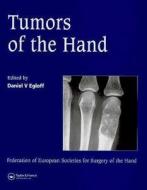 Tumors Of The Hand di V. D. Egloff edito da Taylor & Francis Ltd
