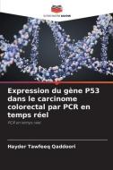 Expression du gène P53 dans le carcinome colorectal par PCR en temps réel di Hayder Tawfeeq Qaddoori edito da Editions Notre Savoir