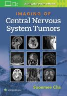 Imaging Of Cns Tumors di Dr. Soonme Cha edito da Wolters Kluwer Health
