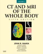 Ct And Mri Of The Whole Body di Daniel Boll, John R. Haaga edito da Elsevier - Health Sciences Division