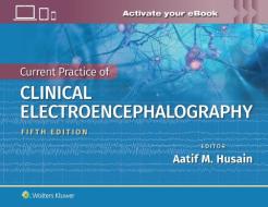 Ebersole's Current Practice of Clinical Electroencephalography di Aatif M. Husain edito da Lippincott Williams&Wilki