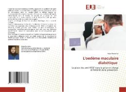L'oedeme Maculaire Diabetique di Boutahar Hajar Boutahar edito da KS OmniScriptum Publishing